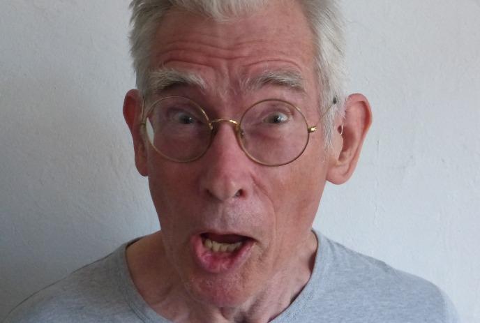 A person with shocking facial features, grey hair, wearing a grey shirt against a white background.